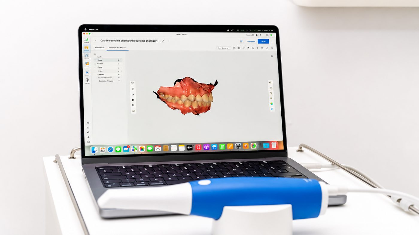 Scanner intra-oral 3D avec modélisation dentaire numérique sur ordinateur à Bright Smile Clinic
